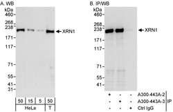 XRN1 Rabbit anti-Human, Mouse, Polyclonal, Bethyl Laboratories 100 &mu;L;