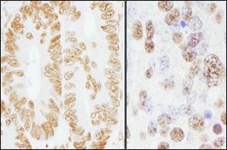 XRN2 Rabbit anti-Human, Mouse, Polyclonal, Bethyl Laboratories 100 &mu;L;