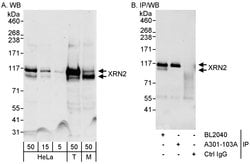 XRN2 Rabbit anti-Human, Mouse, Polyclonal, Bethyl Laboratories 100 &mu;L;