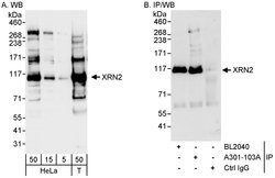 XRN2 Rabbit anti-Human, Mouse, Polyclonal, Bethyl Laboratories 100 &mu;L;