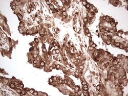 YBX1 Monoclonal Antibody (OTI11A7), TrueMAB , OriGene 100 &mu;L; Unconjugated:Antibodies,