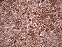 YBX1 Monoclonal Antibody (OTI11A7), TrueMAB , OriGene 100 &mu;L; Unconjugated:Antibodies,