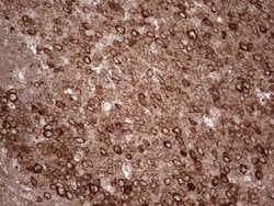 YBX1 Monoclonal Antibody (OTI11A7), TrueMAB , OriGene 100 &mu;L; Unconjugated:Antibodies,
