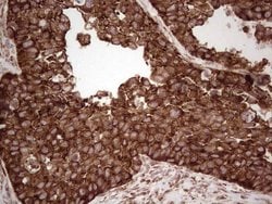 YBX1 Monoclonal Antibody (OTI11A7), TrueMAB , OriGene 100 &mu;L; Unconjugated:Antibodies,