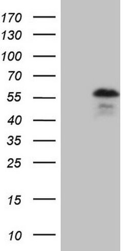 YBX1 Mouse anti-Human, Clone: OTI2C9, lyophilized, TrueMAB 100 &mu;g; Unconjugated:Antibodies,