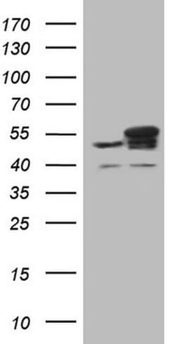 YBX1 Monoclonal Antibody (OTI11A7), TrueMAB , OriGene 100 &mu;L; Unconjugated:Antibodies,