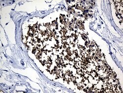 YBX2 Monoclonal Antibody (OTI2D8), TrueMAB , OriGene 30 &mu;L; Unconjugated:Antibodies,