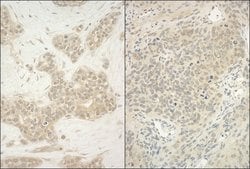 YY1 Rabbit anti-Human, Mouse, Polyclonal, Bethyl Laboratories 100 &mu;L;