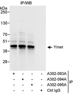 Ymer Rabbit anti-Human, Polyclonal, Bethyl Laboratories 100 &mu;L; Unconjugated:Antibodies,