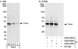Ymer Rabbit anti-Human, Polyclonal, Bethyl Laboratories 100 &mu;l; Unlabeled:Antibodies,