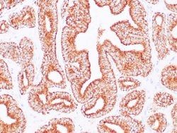 AMACR Recombinant Rabbit Monoclonal Antibody (13H4), Zeta 1mL; Unconjugated:Antibodies,