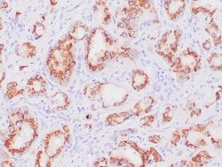 Prostein Recombinant Rabbit Monoclonal Antibody (ZR9), RAbMono , Zeta 500
