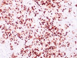 Mammaglobin A Mouse anti-Human, Clone: 304-1A5, Cocktail, Zeta 7mL; Unconjugated:Antibodies,
