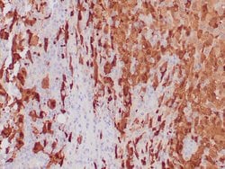 S-100 Mouse anti-Bovine, Human, Clone: 4C4.9, Cocktail, Zeta 7mL; Unconjugated:Antibodies,