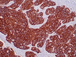 Cytokeratin, Pan Mouse anti-Human, Cocktail, Zeta 7mL; Unconjugated:Antibodies,