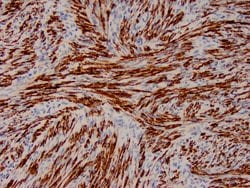 Actin, Smooth Muscle Mouse anti-Human, Clone: 1A4, Cocktail, Zeta 7 mL | Buy Online | ZETA CORPORATION | Fisher Scientific