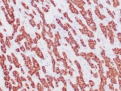 HepPar-1 Monoclonal Antibody (OCH1E5), Zeta:Antibodies:Primary Antibodies