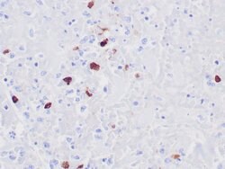 HSV1 Monoclonal Antibody (10A3), Zeta:Antibodies:Primary Antibodies