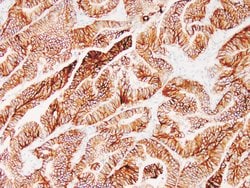 EP-CAM Monoclonal Antibody (Ber-EP4), Zeta 500 &mu;L; Unconjugated:Antibodies,
