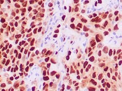TTF-1/NKX2.1 Recombinant Rabbit Monoclonal Antibody (ZR176), RAbMono ,