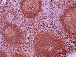 CD79a Recombinant Rabbit Monoclonal Antibody (ZR237), RAbMono , Zeta:Antibodies:Primary