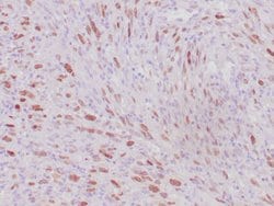 MyoD1 Rabbit anti-Human, Clone: ZR262, Cocktail, Zeta 7mL; Unconjugated:Antibodies,