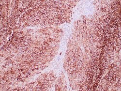 GLUT-1 Rabbit anti-Human, Clone: ZR308, Cocktail, Zeta 7mL; Unconjugated:Antibodies,