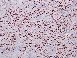 SALL4 Recombinant Rabbit Monoclonal Antibody (ZR276), RAbMono , Zeta:Antibodies:Primary