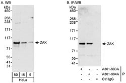 ZAK Rabbit anti-Human, Polyclonal, Bethyl Laboratories 100 &mu;L; Unconjugated:Antibodies,