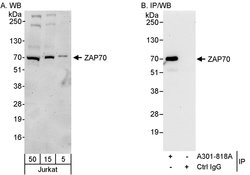 ZAP70 Rabbit anti-Human, Polyclonal, Bethyl Laboratories 100 &mu;L; Unconjugated:Antibodies,