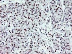 ZBED1 Monoclonal Antibody (OTI2A7), TrueMAB , OriGene 100 &mu;L; Unconjugated:Antibodies,