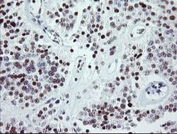 ZBED1 Mouse anti-Human, Clone: OTI2A7, lyophilized, TrueMAB 100 &mu;g;