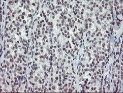 ZBED1 Mouse anti-Human, Clone: OTI2A7, lyophilized, TrueMAB 100 &mu;g;