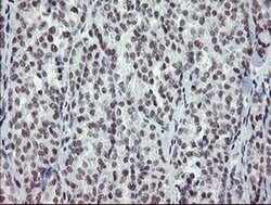 ZBED1 Monoclonal Antibody (OTI2A7), TrueMAB , OriGene 100 &mu;L; Unconjugated:Antibodies,