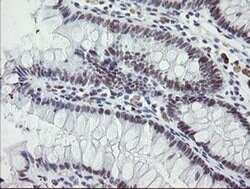 ZBED1 Monoclonal Antibody (OTI2A7), TrueMAB , OriGene 100 &mu;L; Unconjugated:Antibodies,
