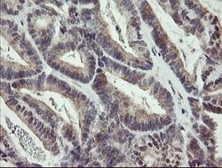ZBED1 Mouse anti-Human, Clone: OTI2E5, lyophilized, TrueMAB 100 &mu;g;