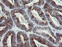 ZBED1 Monoclonal Antibody (OTI1F7), TrueMAB , OriGene 100 &mu;L; Unconjugated:Antibodies,