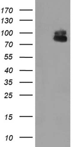 ZBED1 Mouse anti-Human, Clone: OTI1F2, lyophilized, TrueMAB 100 &mu;g;