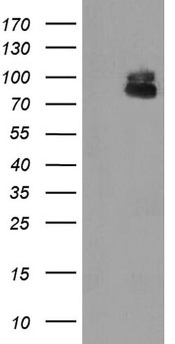 ZBED1 Monoclonal Antibody (OTI1F2), TrueMAB , OriGene 100 &mu;L; Unconjugated:Antibodies,