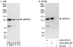 ZBTB10 Rabbit anti-Human, Polyclonal, Bethyl Laboratories 100 &mu;L; Unconjugated:Antibodies,
