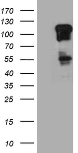 ZBTB17 Monoclonal Antibody (OTI2G1), TrueMAB , OriGene 100 &mu;L; Unconjugated:Antibodies,