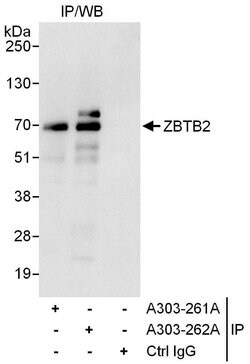 ZBTB2 Rabbit anti-Human, Polyclonal, Bethyl Laboratories 100 &mu;L; Unconjugated:Antibodies,