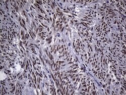 ZBTB4 Monoclonal Antibody (OTI1F6), TrueMAB , OriGene:Antibodies:Primary