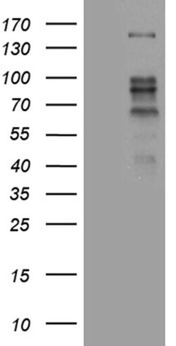 ZBTB4 Monoclonal Antibody (OTI1F6), TrueMAB , OriGene 100 &mu;L; Unconjugated:Antibodies,