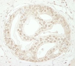 ZBTB40 Polyclonal Antibody, Bethyl Laboratories 10 &mu;L; Unconjugated:Antibodies,