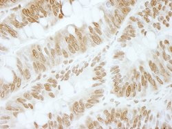 ZBTB40 Polyclonal Antibody, Bethyl Laboratories 10 &mu;L; Unconjugated:Antibodies,