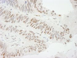 ZBTB7/FBI-1 Polyclonal Antibody, Bethyl Laboratories 100 &mu;L | Buy Online | Bethyl Laboratories, Inc | Fisher Scientific