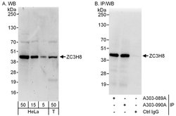 ZC3H8 Rabbit anti-Human, Polyclonal, Bethyl Laboratories 100 &mu;L; Unconjugated:Antibodies,