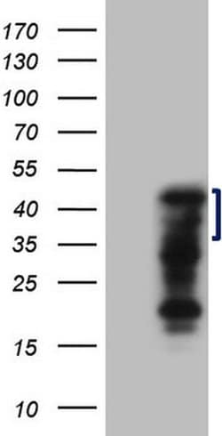 ZC3H8 Monoclonal Antibody (OTI5B12), TrueMAB , OriGene:Antibodies:Primary