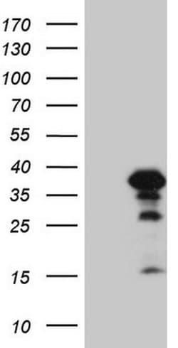 ZC3H8 Monoclonal Antibody (OTI13F2), TrueMAB , OriGene 100 &mu;L; Unconjugated:Antibodies,